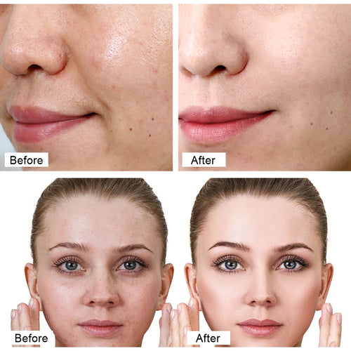  30g Retinol Face Cream for Anti-Aging Care cashymart
