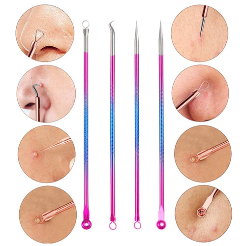  4PCS Acne Blackhead Remover Kit cashymart
