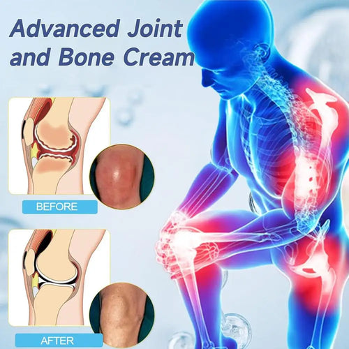  50g Hyaluronic Acid Joint Repair Cream for Pain Relief cashymart