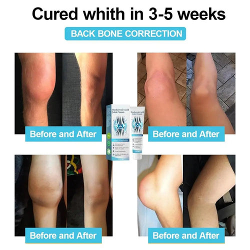  50g Hyaluronic Acid Joint Repair Cream for Pain Relief cashymart