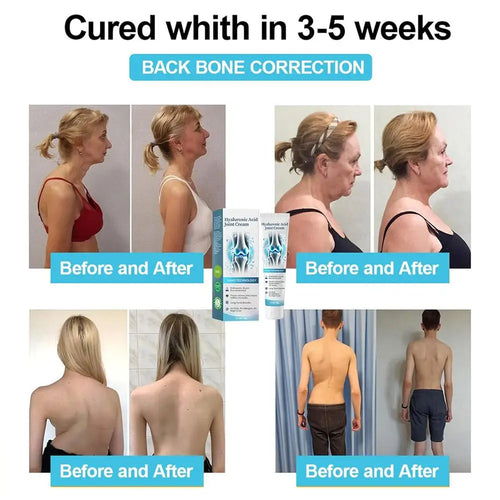  50g Hyaluronic Acid Joint Repair Cream for Pain Relief cashymart