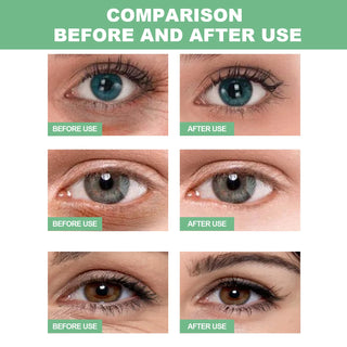  60 Pieces Aloe Vera Collagen Eye Mask for Dark Circles cashymart