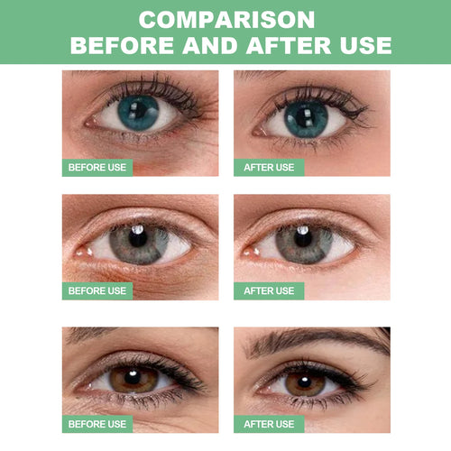  60 Pieces Aloe Vera Collagen Eye Mask for Dark Circles cashymart