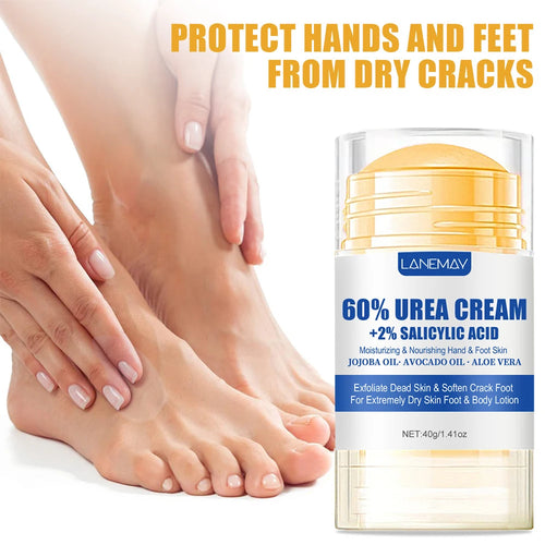  60% Urea Foot Cream for Softening Dry Feet cashymart