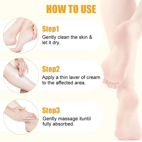  60% Urea Foot Cream for Softening Dry Feet cashymart