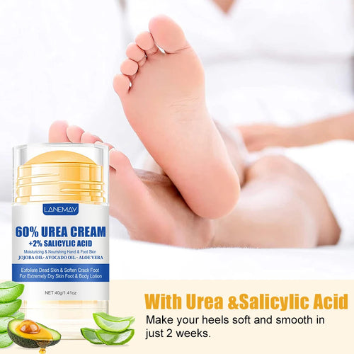  60% Urea Foot Cream for Softening Dry Feet cashymart