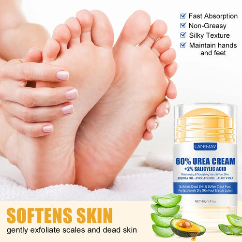  60% Urea Foot Cream for Softening Dry Feet cashymart