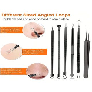 Acne Removal Needle Set for Skincare cashymart