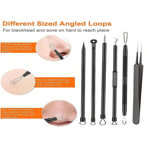  Acne Removal Needle Set for Skincare cashymart