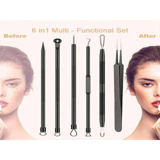  Acne Removal Needle Set for Skincare cashymart