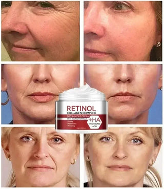  Anti Aging Face Cream for Fine Lines 2025 cashymart