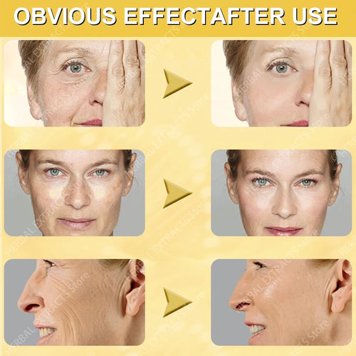  Anti-Aging Serum cashymart