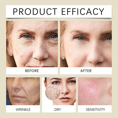  Bee Venom Anti Aging Face Cream 50g cashymart