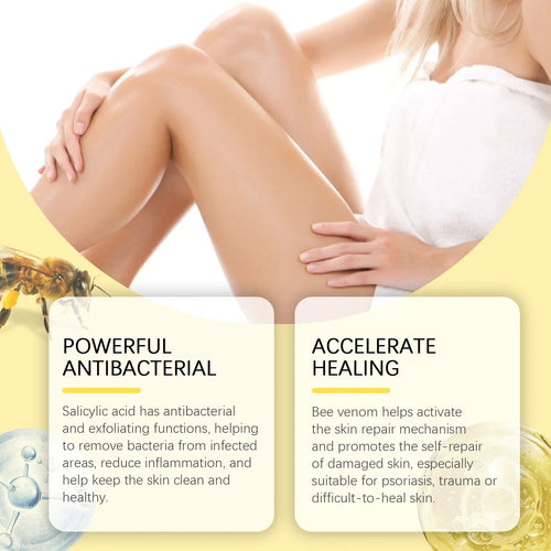  Bee Venom Body Cream 60g for Dry Skin Relief cashymart
