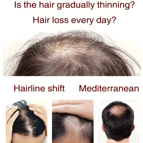  Biotin Keratin Hair Conditioner for Dry Frizz cashymart