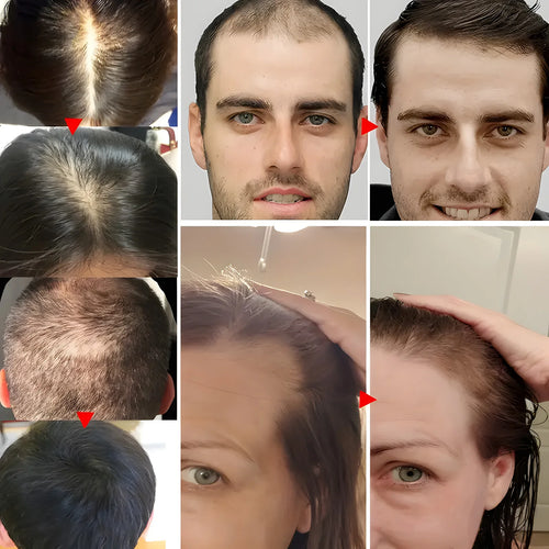  Biotin Keratin Hair Conditioner for Dry Frizz cashymart
