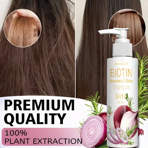 Biotin Rosemary Onion 3 in 1 Shampoo for Hair Care cashymart