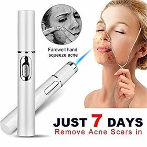  Blue Light Therapy Acne Laser Pen cashymart