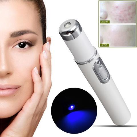  Blue Light Therapy Acne Laser Pen cashymart