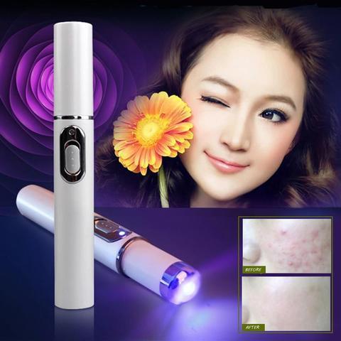  Blue Light Therapy Acne Laser Pen cashymart