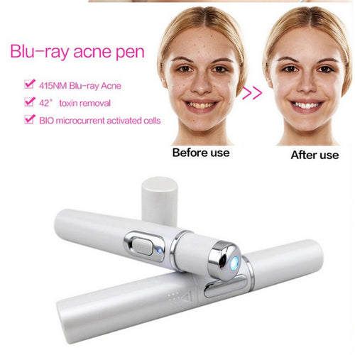  Blue Light Therapy Acne Laser Pen cashymart