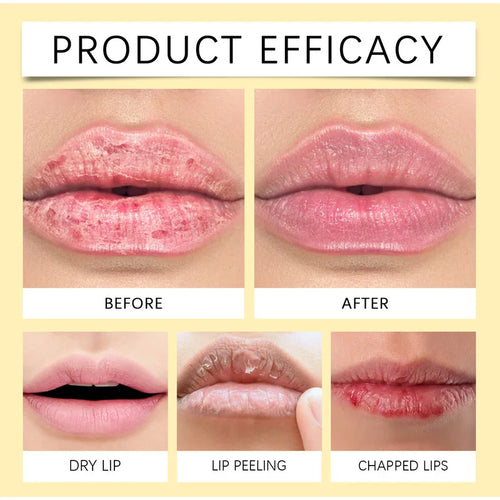  Dark Lip Lightening Balm cashymart