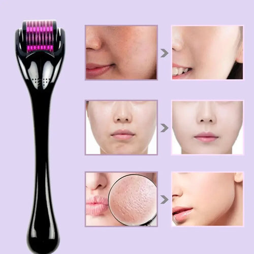  Derma Roller for Beard and Facial Hair Growth 540 Needles cashymart