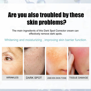  EELHOE Freckle Cream cashymart