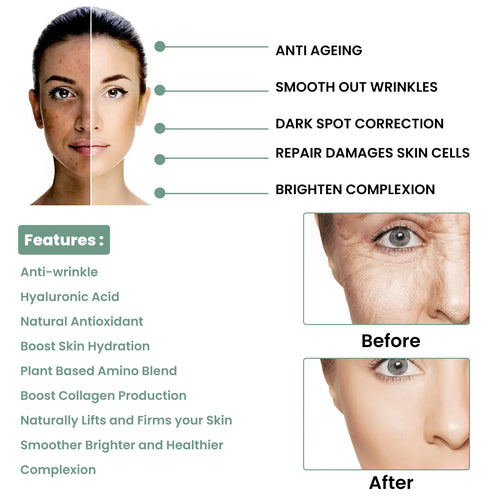  EELHOE Hyaluronic Acid Anti-Aging Serum cashymart