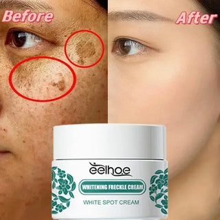  EELHOE Niacinamide Melasma Repair Cream cashymart