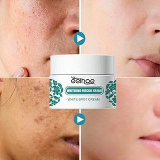  EELHOE Niacinamide Melasma Repair Cream cashymart