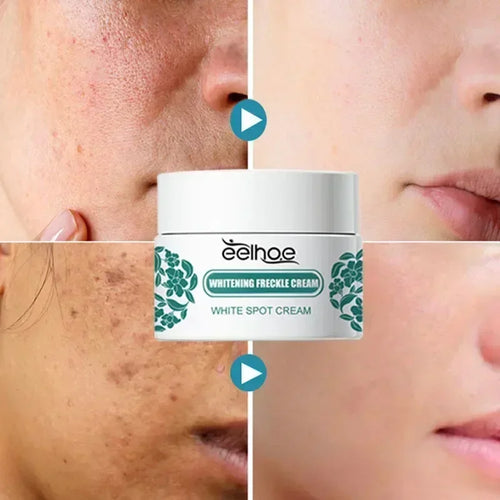  EELHOE Niacinamide Melasma Repair Cream cashymart