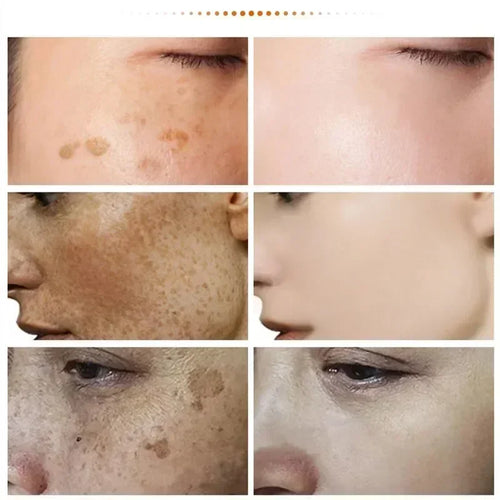  EELHOE Niacinamide Melasma Repair Cream cashymart