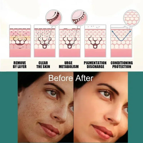  EELHOE Niacinamide Melasma Repair Cream cashymart