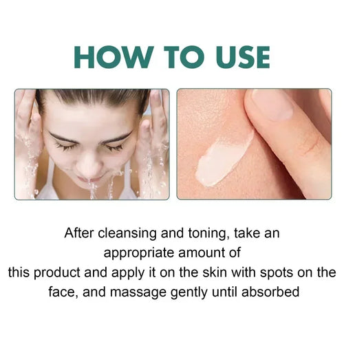  EELHOE Niacinamide Melasma Repair Cream cashymart