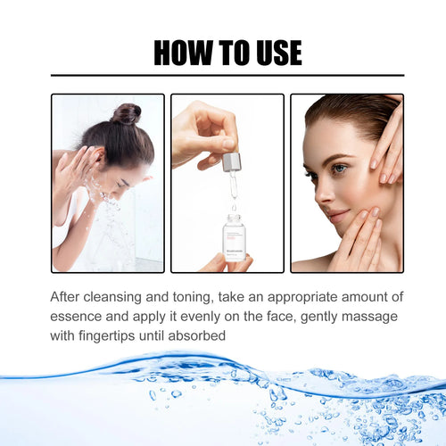  EELHOE Nicotinamide Serum cashymart