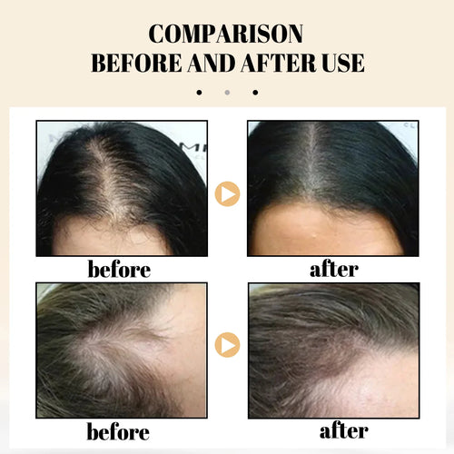  EELHOE Nourishing Hair Growth Bar cashymart