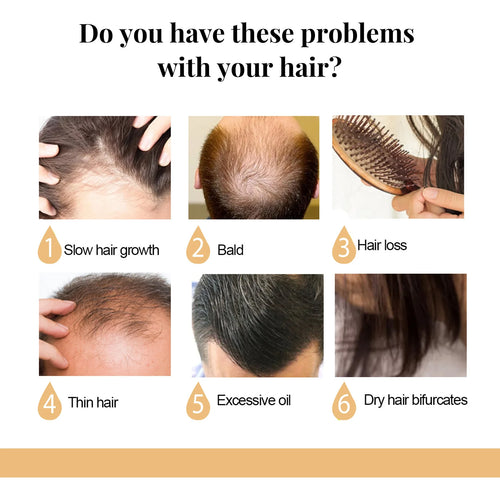 EELHOE Nourishing Hair Growth Bar cashymart