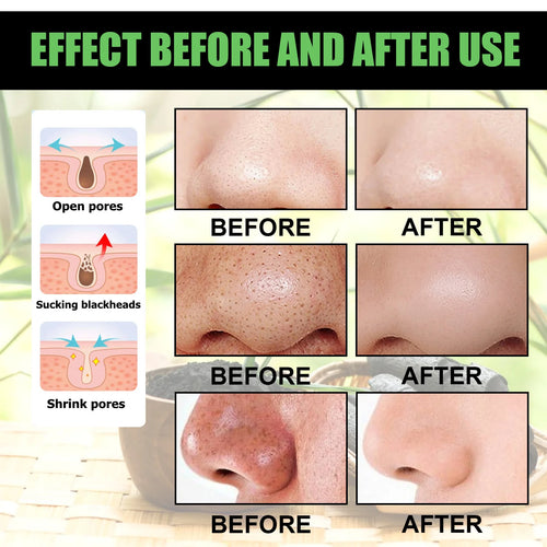  EELHOE Peel-Off Mask cashymart