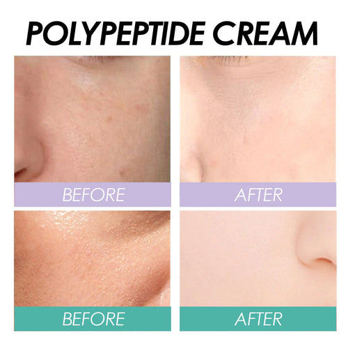  EELHOE Polypeptide Anti-Aging Moisturizer cashymart