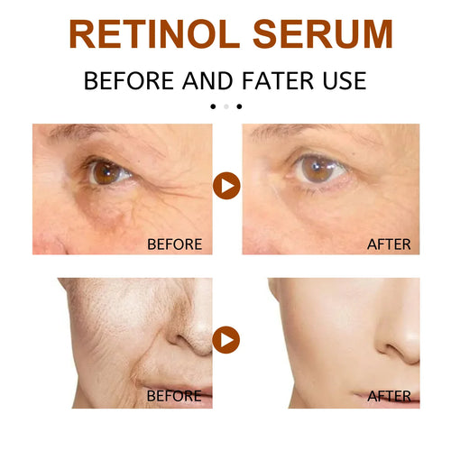  EELHOE Rejuvenating Retinol Serum cashymart