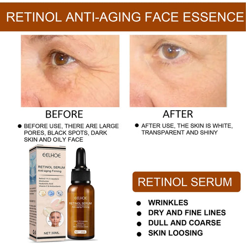  EELHOE Rejuvenating Retinol Serum cashymart