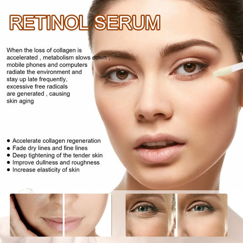  EELHOE Rejuvenating Retinol Serum cashymart
