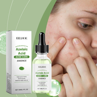  EELHOE Rejuvenating Salicylic Acid Serum cashymart