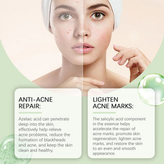  EELHOE Rejuvenating Salicylic Acid Serum cashymart