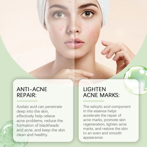  EELHOE Rejuvenating Salicylic Acid Serum cashymart