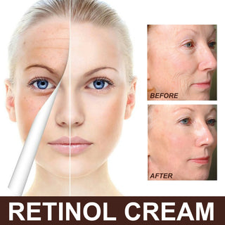  EELHOE Retinol Face Cream for Youthful Skin cashymart