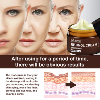  EELHOE Retinol Face Cream for Youthful Skin cashymart