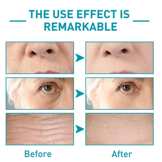  EELHOE Revitalizing Anti-Wrinkle Serum cashymart