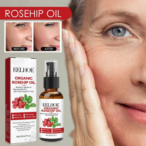  EELHOE Rosehip Serum cashymart